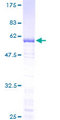 TFIIB Protein - 12.5% SDS-PAGE of human GTF2B stained with Coomassie Blue