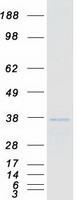 TFIIB Protein - Purified recombinant protein GTF2B was analyzed by SDS-PAGE gel and Coomassie Blue Staining