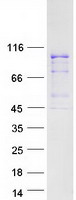 TFIP11 Protein - Purified recombinant protein TFIP11 was analyzed by SDS-PAGE gel and Coomassie Blue Staining
