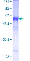 TFPI / LACI Protein - 12.5% SDS-PAGE of human TFPI stained with Coomassie Blue