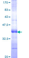 TFPI / LACI Protein - 12.5% SDS-PAGE Stained with Coomassie Blue.