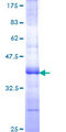 TFPI / LACI Protein - 12.5% SDS-PAGE Stained with Coomassie Blue.