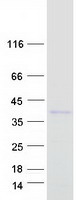 TFPI / LACI Protein - Purified recombinant protein TFPI was analyzed by SDS-PAGE gel and Coomassie Blue Staining