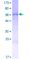 TFPT / Amida Protein - 12.5% SDS-PAGE of human TFPT stained with Coomassie Blue