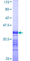 TG / Thyroglobulin Protein - 12.5% SDS-PAGE Stained with Coomassie Blue.