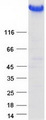 TG / Thyroglobulin Protein - Purified recombinant protein TG was analyzed by SDS-PAGE gel and Coomassie Blue Staining