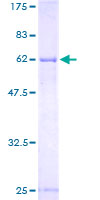 TGDS Protein - 12.5% SDS-PAGE of human TGDS stained with Coomassie Blue