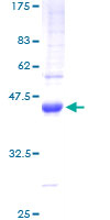 TGFA / TGF Alpha Protein - 12.5% SDS-PAGE of human TGFA stained with Coomassie Blue