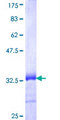 TGFA / TGF Alpha Protein - 12.5% SDS-PAGE Stained with Coomassie Blue.