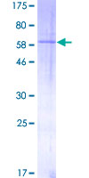 TGFB1 / TGF Beta 1 Protein - 12.5% SDS-PAGE of human TGFB1 stained with Coomassie Blue