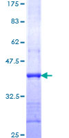 TGFB1 / TGF Beta 1 Protein - 12.5% SDS-PAGE Stained with Coomassie Blue.