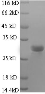 TGFB2 / TGF Beta2 Protein - (Tris-Glycine gel) Discontinuous SDS-PAGE (reduced) with 5% enrichment gel and 15% separation gel.