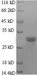 TGFB2 / TGF Beta2 Protein - (Tris-Glycine gel) Discontinuous SDS-PAGE (reduced) with 5% enrichment gel and 15% separation gel.