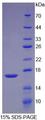 TGFB2 / TGF Beta2 Protein - Recombinant Transforming Growth Factor Beta 2 By SDS-PAGE
