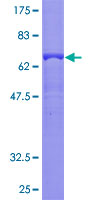 TGFB4 / LEFTY2 Protein - 12.5% SDS-PAGE of human LEFTY2 stained with Coomassie Blue
