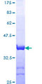 TGFBI Protein - 12.5% SDS-PAGE Stained with Coomassie Blue.
