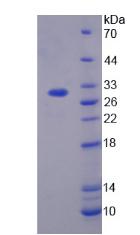 TGFBI Protein - Recombinant Transforming Growth Factor Beta Induced Protein By SDS-PAGE