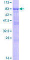 TGFBR2 Protein - 12.5% SDS-PAGE of human TGFBR2 stained with Coomassie Blue