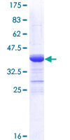 TGFBR2 Protein - 12.5% SDS-PAGE Stained with Coomassie Blue.