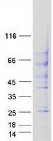 TGFBR2 Protein - Purified recombinant protein TGFBR2 was analyzed by SDS-PAGE gel and Coomassie Blue Staining