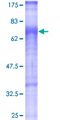 TGFBRAP1 / TRAP-1 Protein - 12.5% SDS-PAGE of human TGFBRAP1 stained with Coomassie Blue