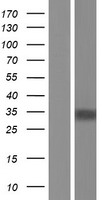 TGIF1 Protein - Western validation with an anti-DDK antibody * L: Control HEK293 lysate R: Over-expression lysate