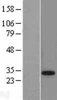 TGIF1 Protein - Western validation with an anti-DDK antibody * L: Control HEK293 lysate R: Over-expression lysate