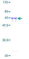 TGIF1 Protein - 12.5% SDS-PAGE of human TGIF stained with Coomassie Blue