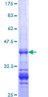 TGIF1 Protein - 12.5% SDS-PAGE Stained with Coomassie Blue.