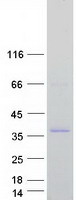 TGIF1 Protein - Purified recombinant protein TGIF1 was analyzed by SDS-PAGE gel and Coomassie Blue Staining