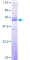 TGIF2 Protein - 12.5% SDS-PAGE of human TGIF2 stained with Coomassie Blue