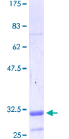 TGIF2 Protein - 12.5% SDS-PAGE Stained with Coomassie Blue.
