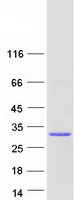 TGIF2LY Protein - Purified recombinant protein TGIF2LY was analyzed by SDS-PAGE gel and Coomassie Blue Staining