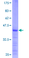 TGM1 / Transglutaminase Protein - 12.5% SDS-PAGE of human TGM1 stained with Coomassie Blue