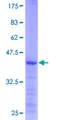 TGM1 / Transglutaminase Protein - 12.5% SDS-PAGE of human TGM1 stained with Coomassie Blue