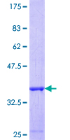TGM1 / Transglutaminase Protein - 12.5% SDS-PAGE Stained with Coomassie Blue.