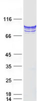TGM1 / Transglutaminase Protein - Purified recombinant protein TGM1 was analyzed by SDS-PAGE gel and Coomassie Blue Staining