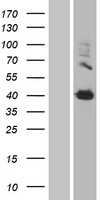 TGM2 / Transglutaminase 2 Protein - Western validation with an anti-DDK antibody * L: Control HEK293 lysate R: Over-expression lysate