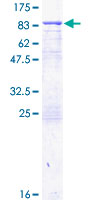TGM2 / Transglutaminase 2 Protein - 12.5% SDS-PAGE of human TGM2 stained with Coomassie Blue