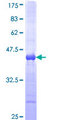 TGM2 / Transglutaminase 2 Protein - 12.5% SDS-PAGE Stained with Coomassie Blue.