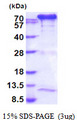 TGM2 / Transglutaminase 2 Protein