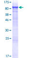 TGM4 / Transglutaminase 4 Protein - 12.5% SDS-PAGE of human TGM4 stained with Coomassie Blue