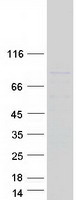TGM5 / Transglutaminase 5 Protein - Purified recombinant protein TGM5 was analyzed by SDS-PAGE gel and Coomassie Blue Staining