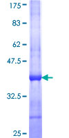 TGM7 / Transglutaminase 7 Protein - 12.5% SDS-PAGE Stained with Coomassie Blue.