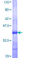 TGM7 / Transglutaminase 7 Protein - 12.5% SDS-PAGE Stained with Coomassie Blue.