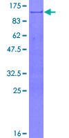 TGN46 / TGN38 Protein - 12.5% SDS-PAGE of human TGOLN2 stained with Coomassie Blue
