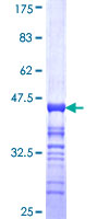 TGN46 / TGN38 Protein - 12.5% SDS-PAGE Stained with Coomassie Blue.