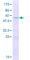 THAP2 Protein - 12.5% SDS-PAGE of human THAP2 stained with Coomassie Blue
