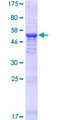 THAP5 Protein - 12.5% SDS-PAGE of human THAP5 stained with Coomassie Blue