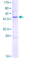 THAP6 Protein - 12.5% SDS-PAGE of human THAP6 stained with Coomassie Blue